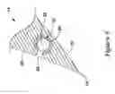 Fig. 09 - Devices for abluminally coating medical devices