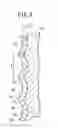 Fig. 10 - Piston for internal combustion engine