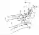 Fig. 01 - TRACHEAL STOMA DILATION APPARATUS AND METHOD OF MANUFACTURE