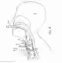 Fig. 05 - TRACHEAL STOMA DILATION APPARATUS AND METHOD OF MANUFACTURE