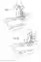 Fig. 07 - TRACHEAL STOMA DILATION APPARATUS AND METHOD OF MANUFACTURE