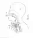 Fig. 11 - TRACHEAL STOMA DILATION APPARATUS AND METHOD OF MANUFACTURE