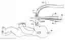 Fig. 01 - Ventilation circuit adaptor and proximal aerosol delivery system