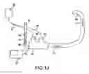 Fig. 14 - Ventilation circuit adaptor and proximal aerosol delivery system