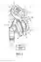Fig. 02 - Patient interface device with dynamic mask adjustment