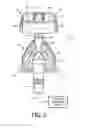Fig. 03 - Patient interface device with dynamic mask adjustment