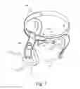Fig. 04 - HOLDING DEVICE FOR A RESPIRATORY MASK