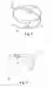 Fig. 05 - HOLDING DEVICE FOR A RESPIRATORY MASK