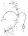 Fig. 01 - TRACHEAL TUBE WITH CONTROLLED-PROFILE CUFF