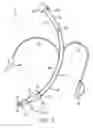 Fig. 02 - TRACHEAL TUBE WITH CONTROLLED-PROFILE CUFF