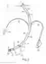 Fig. 03 - TRACHEAL TUBE WITH CONTROLLED-PROFILE CUFF