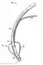 Fig. 01 - ENDOTRACHEAL CUFF AND TECHNIQUE FOR USING THE SAME