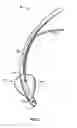 Fig. 02 - ENDOTRACHEAL CUFF AND TECHNIQUE FOR USING THE SAME