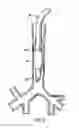 Fig. 03 - ENDOTRACHEAL CUFF AND TECHNIQUE FOR USING THE SAME