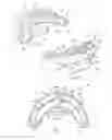 Fig. 02 - Oral orthosis