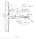 Fig. 13 - Body cleansing apparatus
