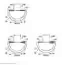 Fig. 03 - DENTAL INTERPROXIMAL CLEANING DEVICE