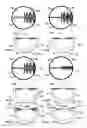 Fig. 04 - DENTAL INTERPROXIMAL CLEANING DEVICE