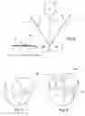 Fig. 03 - Absorbent Article With Double-Sided Soft And Elastic Components