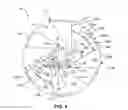 Fig. 08 - Method of forming a reel having corrugated flanges
