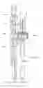 Fig. 01 - Fitting device
