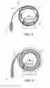 Fig. 04 - WELLBORE LASER OPERATIONS