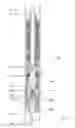Fig. 07 - Casing fill-up fluid management tool
