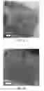 Fig. 05 - Crystallographically-oriented carbon nanotubes grown on few-layer graphene films