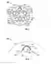 Fig. 03 - Drilling motors with elastically deformable lobes