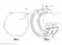 Fig. 05 - Viscous Fan Drive for an Engine Cooling System