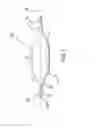 Fig. 02 - Method of reducing rigidity of angioplasty balloon sections