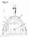 Fig. 03 - Spray hood