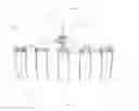 Fig. 02 - MULTI-FUNCTIONAL HAND RAKE