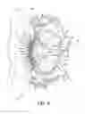 Fig. 06 - Projectile