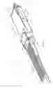 Fig. 02 - ACTIVE OPTICAL CABLE (AOC) HAVING A PLASTIC OPTICAL PORT THAT ATTACHES TO AN END OF AN OPTICAL FIBER CABLE OF THE AOC, AND A METHOD OF ASSEMBLING THE AOC