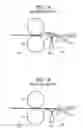 Fig. 02 - Media guide mechanism, fixing device and image forming apparatus incorporating same