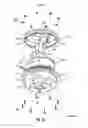 Fig. 03 - Adjustable fail-safe rotary spring operator with a retaining band