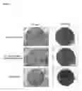 Fig. 02 - Chimeric polypeptides and their use in bacterial decolonization