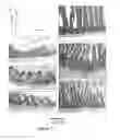Fig. 08 - Methods for Treating Inflammation and Oxidative Stress Related Diseases