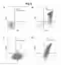 Fig. 07 - Methods for generating T lymphocytes from hematopoietic stem cells