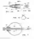 Fig. 04 - Apparatus and Methods for Anastomosis