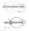 Fig. 06 - Apparatus and Methods for Anastomosis