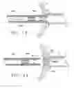 Fig. 07 - Apparatus and Methods for Anastomosis
