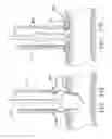 Fig. 15 - Apparatus and Methods for Anastomosis