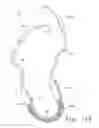 Fig. 16 - Apparatus and Methods for Anastomosis