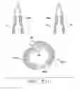 Fig. 27 - Apparatus and Methods for Anastomosis