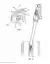 Fig. 02 - Methods and systems for interbody implant and bone graft delivery