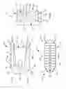 Fig. 04 - Methods and systems for interbody implant and bone graft delivery