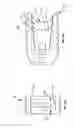 Fig. 06 - Methods and systems for interbody implant and bone graft delivery