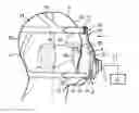 Fig. 01 - PATIENT INTERFACE DEVICE EMPLOYING A FLOATING ADJUSTABLE ARM